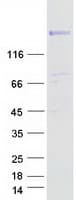 Human RAPGEF6 Protein (Recombinant Myc-DDK (Flag))