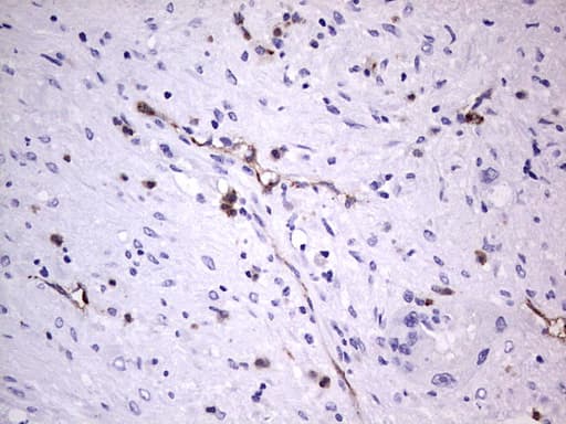 VWF / Von Willebrand Factor Antibody (aa764-1263, clone OTI7G3, Carrier-free)