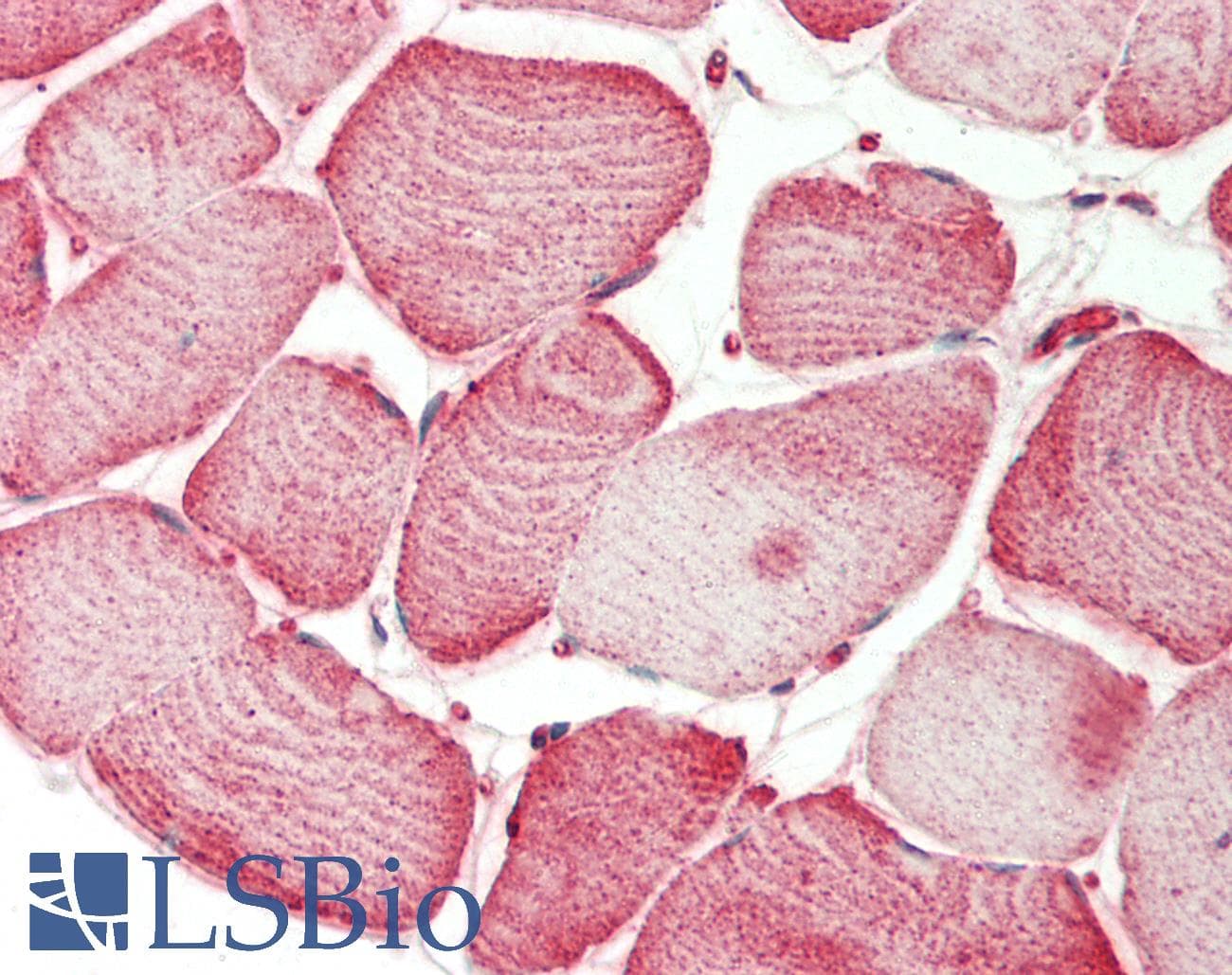 IHC-plus™ Polyclonal Rabbit anti-Human SEMA4D / Semaphorin 4D / CD100 Antibody (aa812-862, IHC, WB)