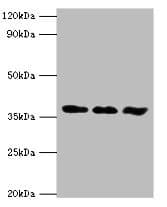 IHC-plus™ ALK2 / ACVR1 Antibody (aa20-125)