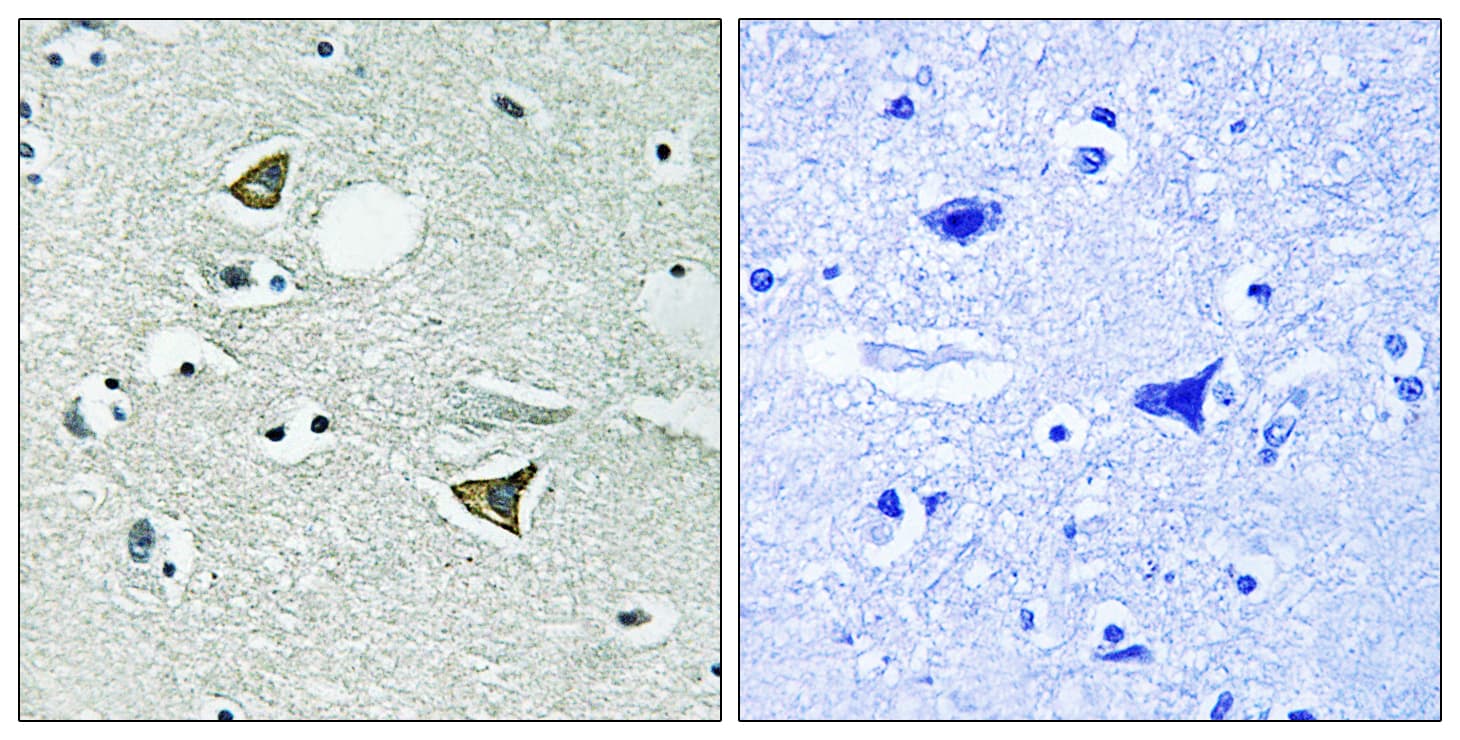 CCDC88A / GIV / Girdin Antibody (aa1383-1432)
