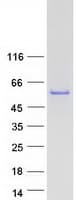 Human ZFYVE27 / Protrudin Protein (Recombinant Myc-DDK (Flag))