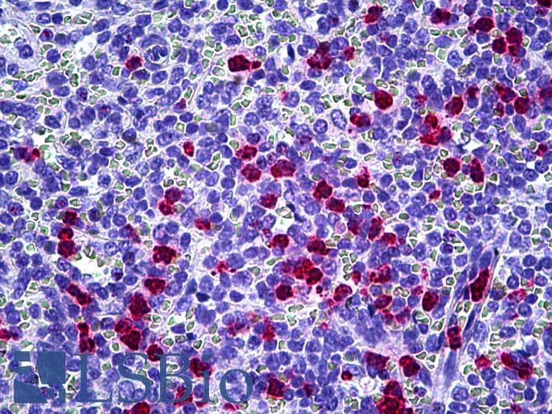 IHC-plus™ LL37 / Cathelicidin Antibody
