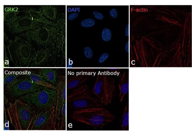 ADRBK1 / GRK2 Antibody (clone 3F8)