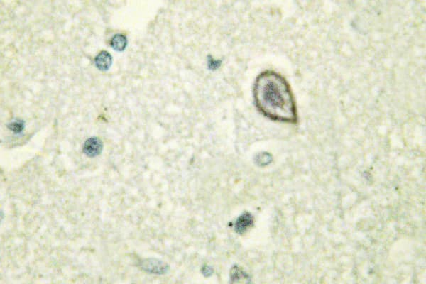 CSF1R / CD115 / FMS Antibody (Gln718)