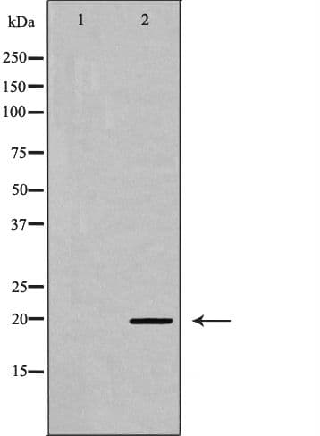 MLC2 / MYL9 Antibody (phospho-Ser18)