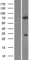 MTMR6 Protein (Over-Expression Lysate Myc-DDK (Flag))