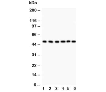Polyclonal Rabbit anti-Human GFAP Antibody (IHC, WB)