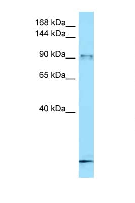 FBXO11 Antibody (aa726-775)