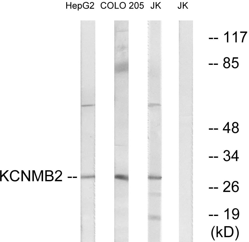 Polyclonal Rabbit anti-Human KCNMB2 Antibody (aa151-200, WB)