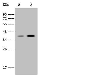 HAVCR2 / TIM-3 Antibody