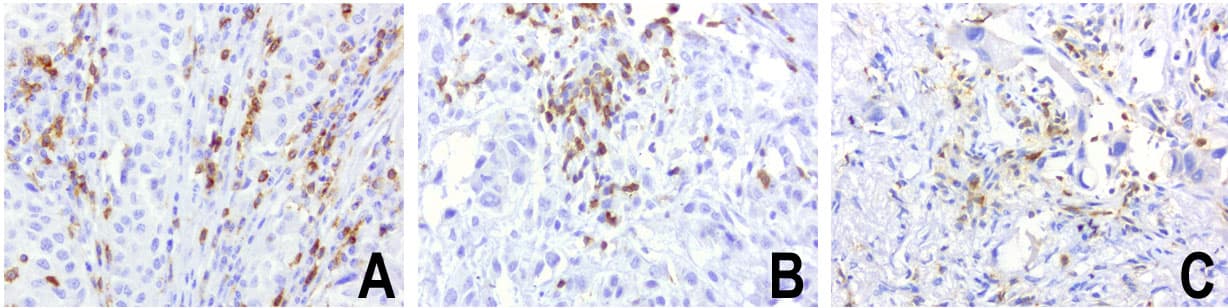 PDCD1 / CD279 / PD-1 Antibody (clone UMAB199, Carrier-free)