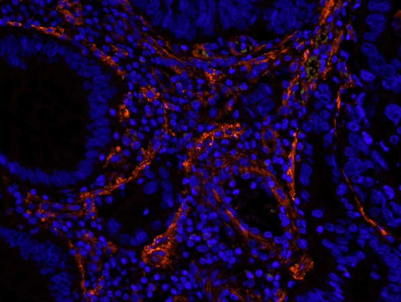 FLNA / Filamin A Antibody (aa1725-1775)