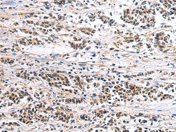 Polyclonal Rabbit anti-Human CLC-7 / CLCN7 Antibody (IHC)