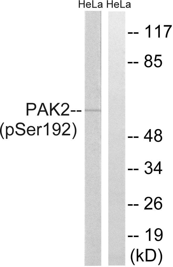 PAK2 Antibody (phospho-Ser192)