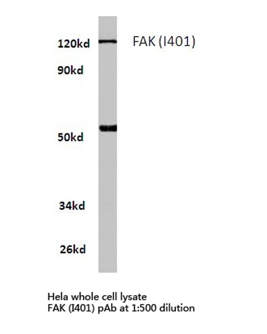 FAK / Focal Adhesion Kinase Antibody (Ile401)