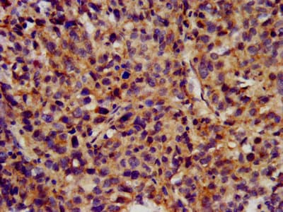 Polyclonal Rabbit anti-Human KCNC3 / Kv3.3 Antibody (IHC, IF)