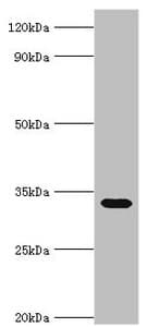 Polyclonal Rabbit anti-Human STOM / Stomatin Antibody (aa55-288, IHC, WB)