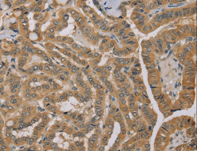 MVK Antibody
