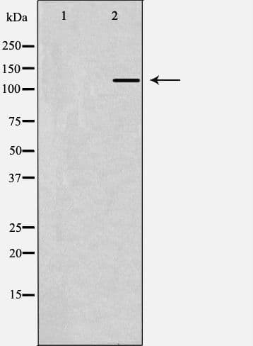 ZEB1 / AREB6 Antibody