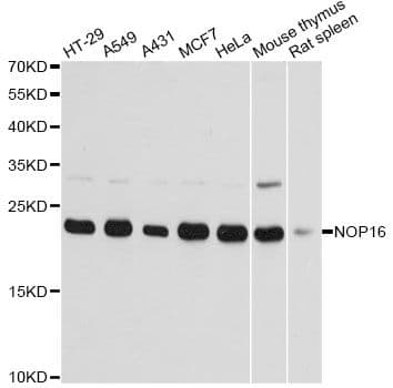 Polyclonal Rabbit anti-Human NOP16 Antibody (WB)