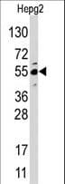 JMJD4 Antibody (aa1-30)