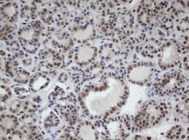 Cullin 4B / CUL4B Antibody (clone OTI1C4)