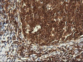 PIK3CG / PI3K Gamma Antibody (clone OTI4D3)