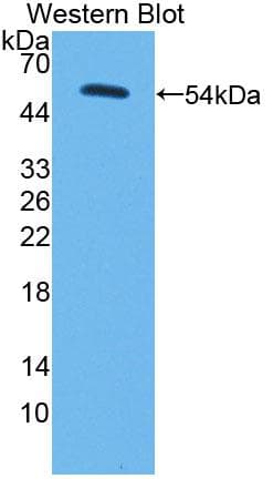 PC / Pyruvate Carboxylase Antibody (aa36-486)