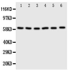 Polyclonal Rabbit anti-Human SCLY Antibody (aa432-445, WB)