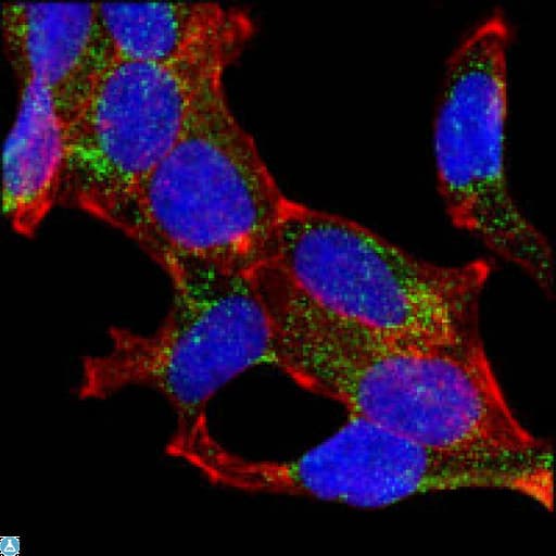 AMACR / P504S Antibody