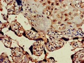 Polyclonal Rabbit anti-Human GPER1 / GPR30 Antibody (aa1-62, IHC, IF, WB)