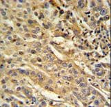 FAM91A1 Antibody (aa127-155)