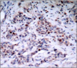 Polyclonal Rabbit anti-Human RELA / NFKB p65 Antibody (IHC, IF, WB)