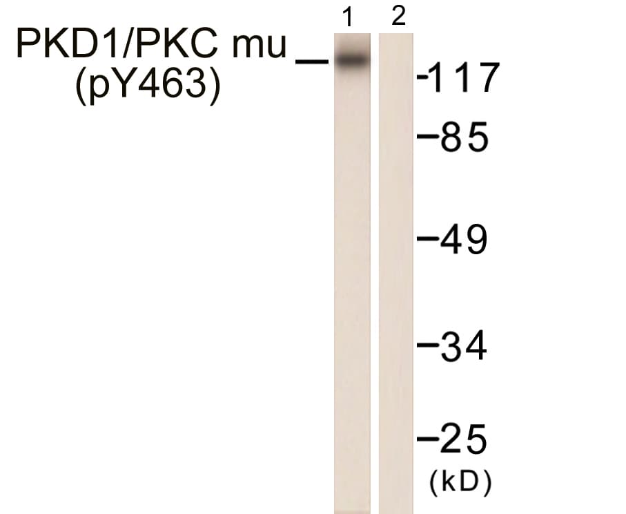 PRKD1 / PKC Mu Antibody (phospho-Tyr463)