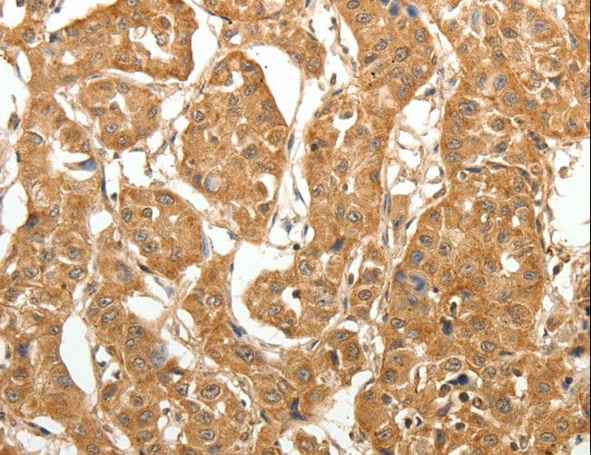 MAP1B Antibody