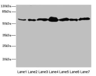 Polyclonal Rabbit anti-Human NAE1 / APPBP1 Antibody (IHC, WB)