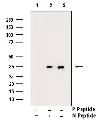 CDK1 / CDC2 Antibody (phospho-Thr14)