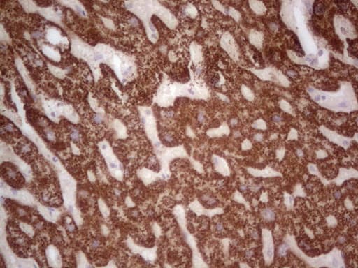 ABAT Antibody (aa29-323, clone OTI7H1, Carrier-free)