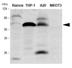 Monoclonal Mouse anti-Human IRF5 Antibody (clone 10T1, IHC, WB)
