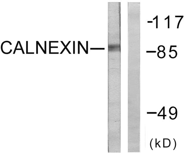 Polyclonal Rabbit anti-Human CANX / Calnexin Antibody (p583, IHC, IF, WB)