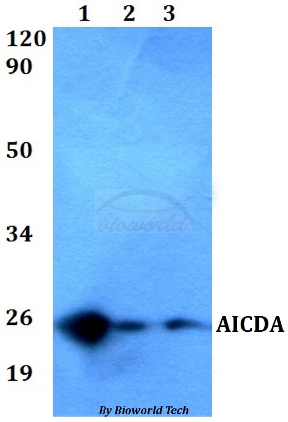Polyclonal Rabbit anti-Human AICDA / AID Antibody (WB)