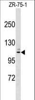 MARCH10 Antibody (aa248-274)