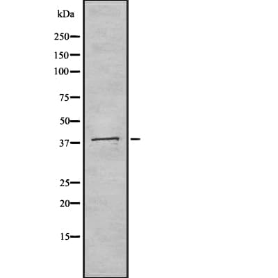 BGN / Biglycan Antibody