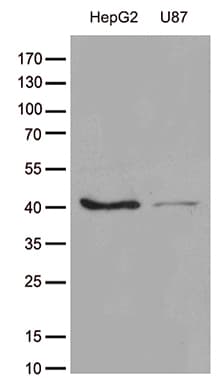 GALM / Mutarotase Antibody (clone OTI2F8)