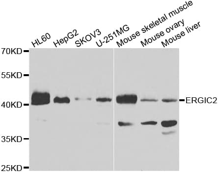 Polyclonal Rabbit anti-Human ERGIC2 Antibody (IHC, WB)