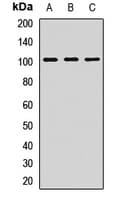 Polyclonal Rabbit anti-Human DLG1 / SAP97 Antibody (IHC, WB)