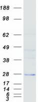 Human DCTN6 / Dynactin 6 Protein (Recombinant Myc-DDK (Flag))