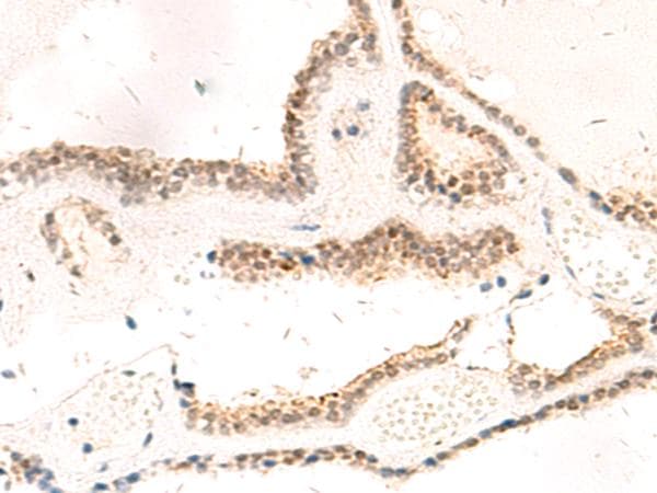 RPL13A Antibody