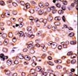 CDKN1A / WAF1 / p21 Antibody (phospho-Thr145)